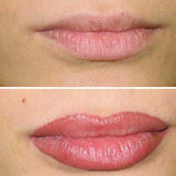 Ombre Lips - Aspya Cosmetic Tattoo & Skin Clinic